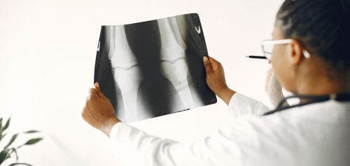 Doctor reviewing knee X-ray
